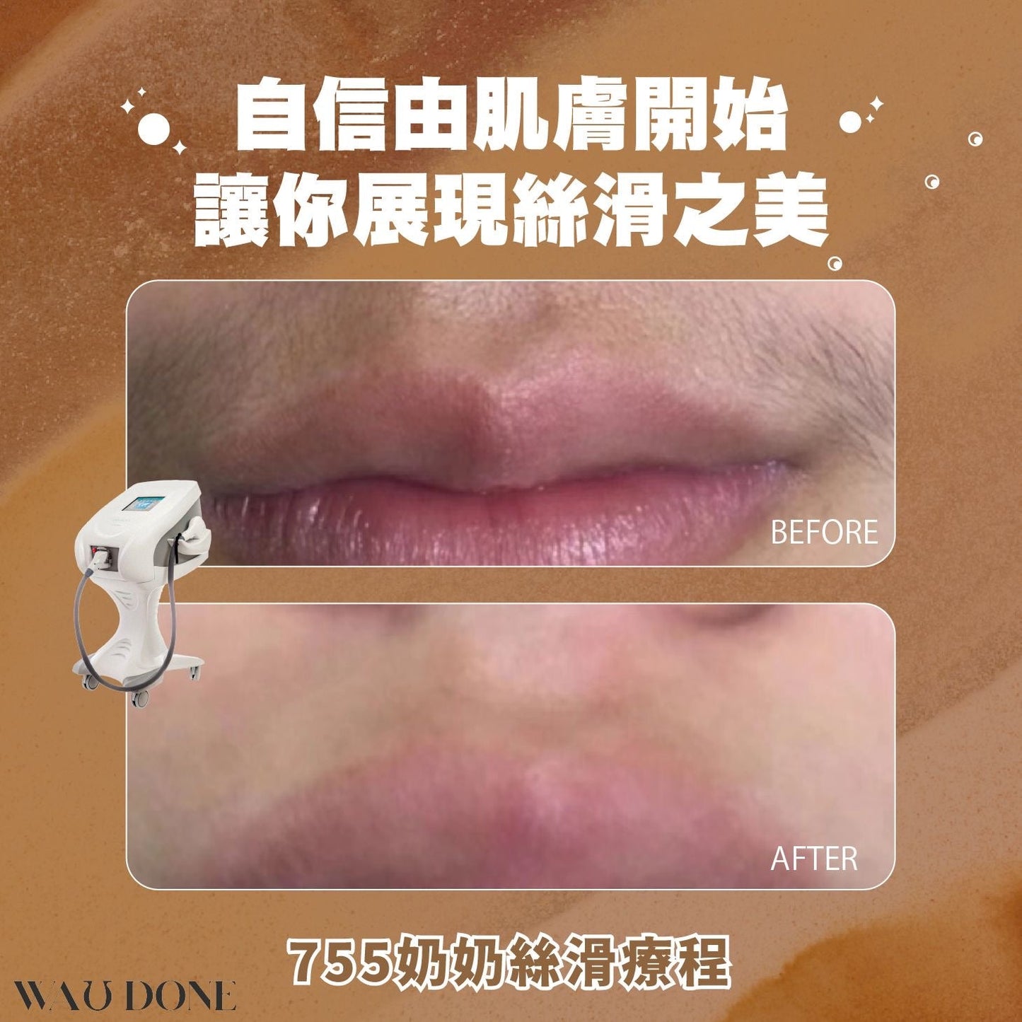 755奶奶絲滑療程 (優惠)