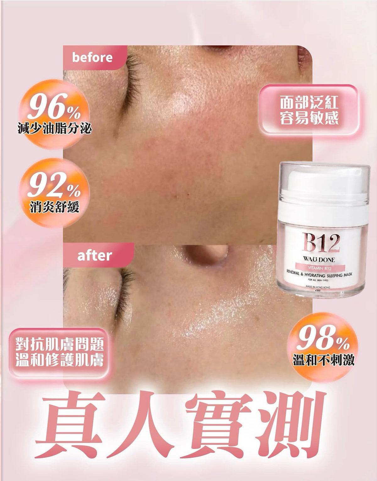 「For4 you週年慶」面膜任選買一送一