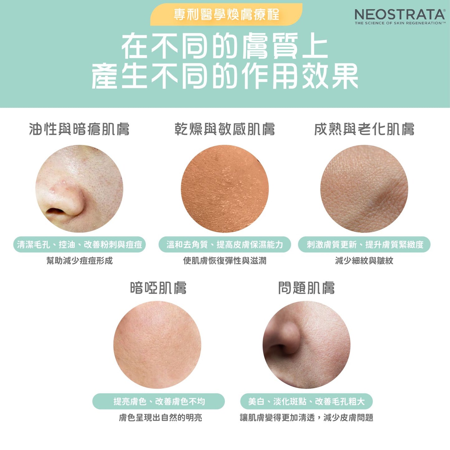 Neo Strara醫學煥膚療程