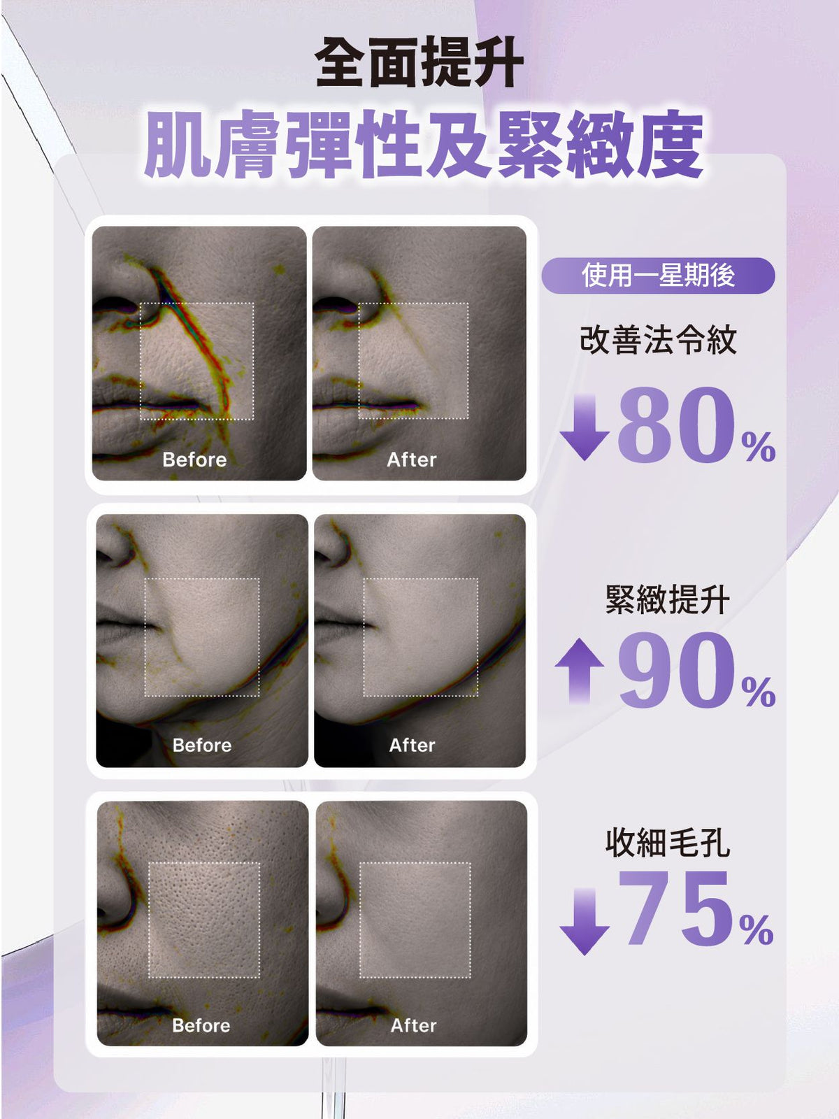 「For4 you週年慶」水解魚子醬膠原蛋白緊緻精華30ML 買一送一
